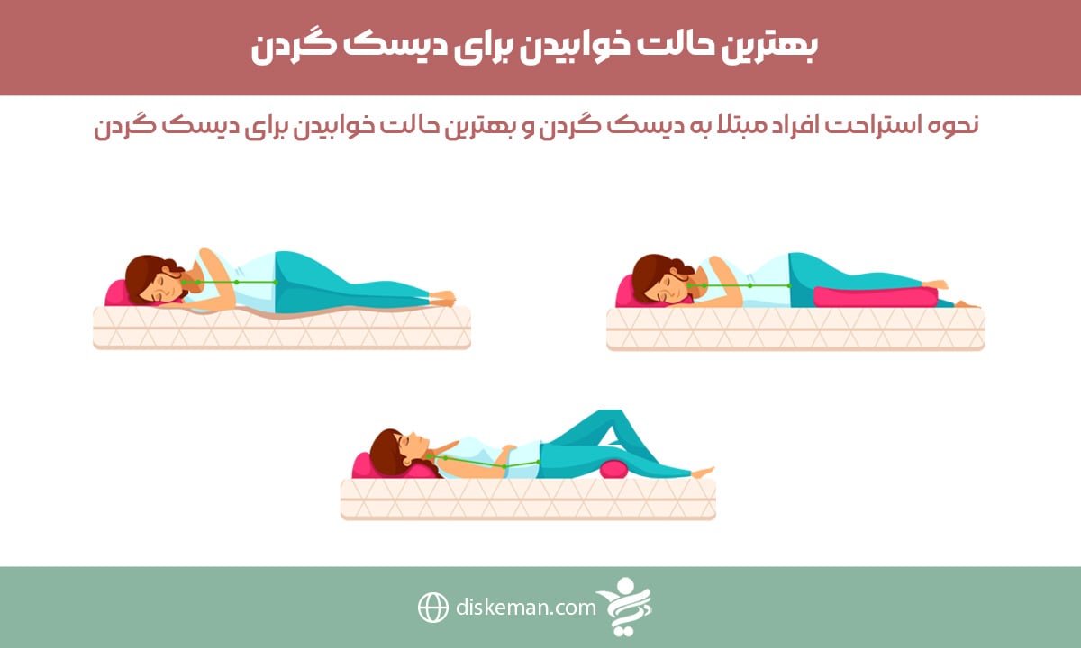 بهترین حالت خوابیدن برای دیسک گردن